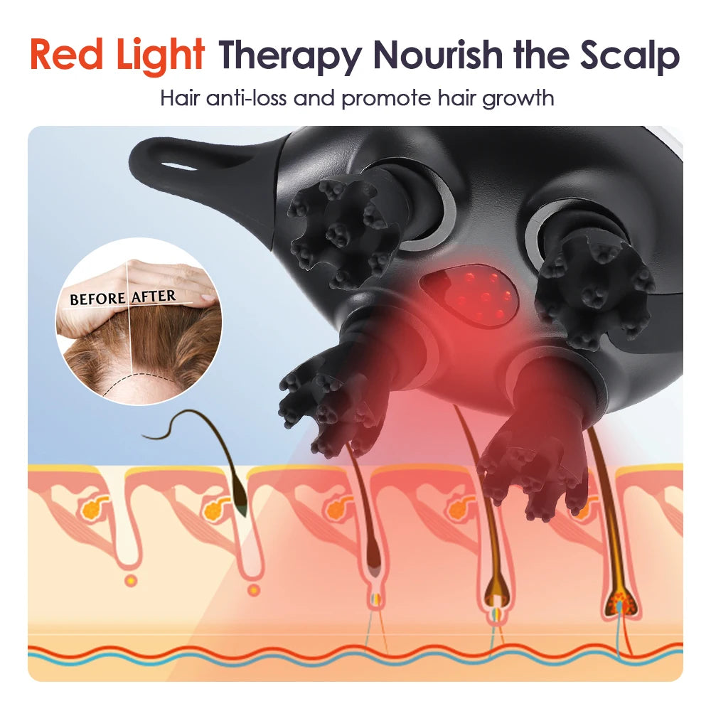 Electric Scalp Massager