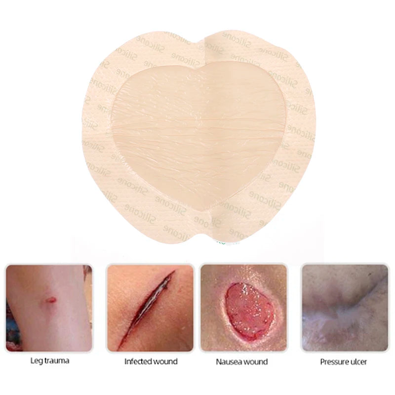 Silicone Wound Patch