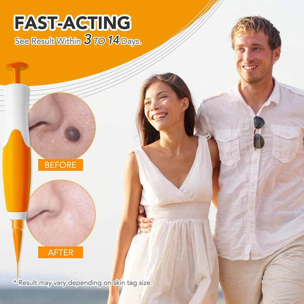 Mole Wart Remover Kit