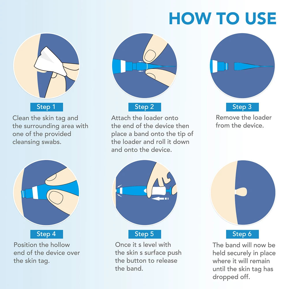 Mole Wart Remover Kit